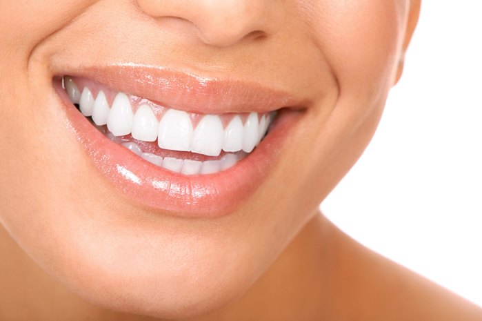 Denti larghi rimedi, faccette estetiche ?