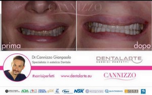 caso clinico implantologia dentale