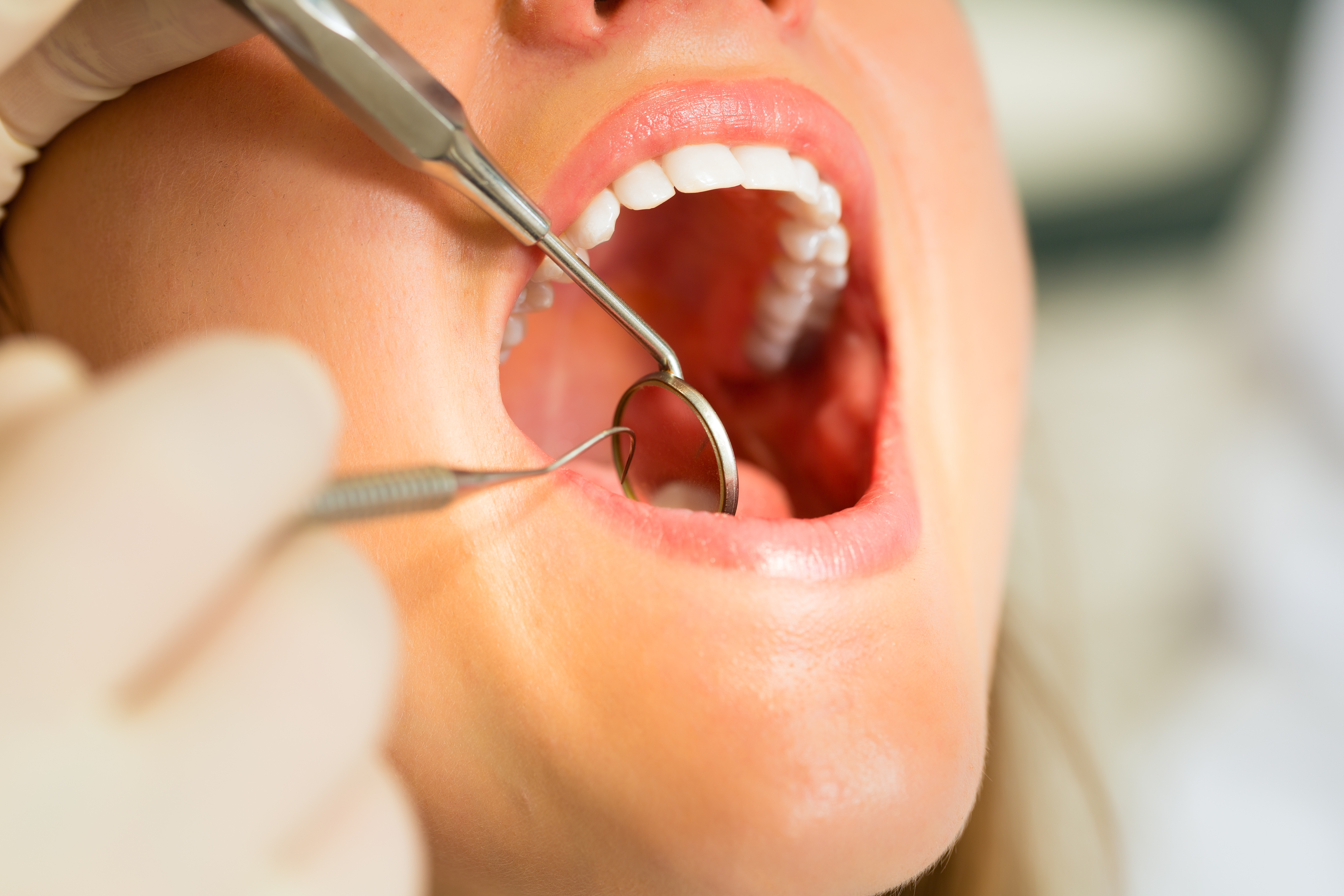 Восстановление полости рта. Фотографирование полости рта. Патологии ротовой полости.